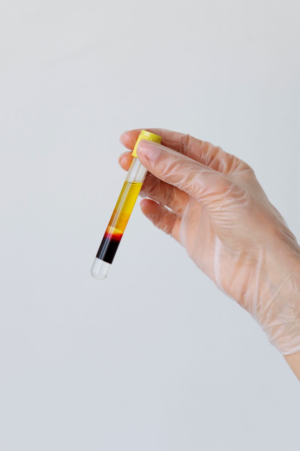 blood in urine