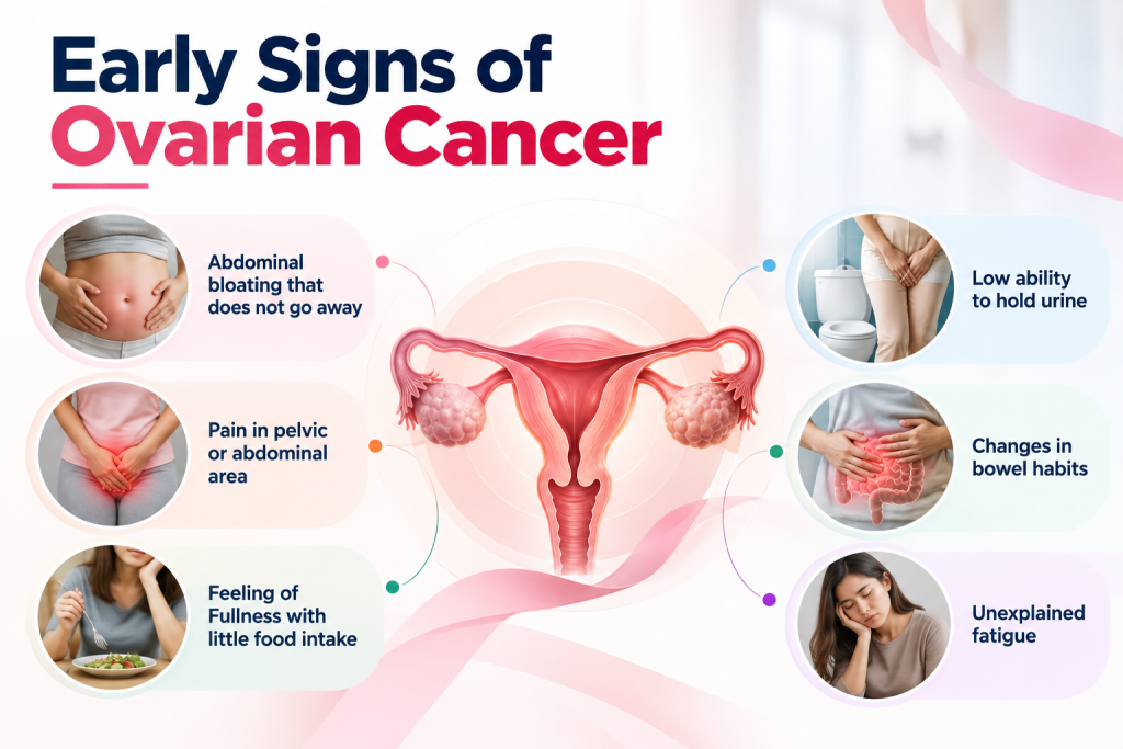 Early Signs of Ovarian Cancer